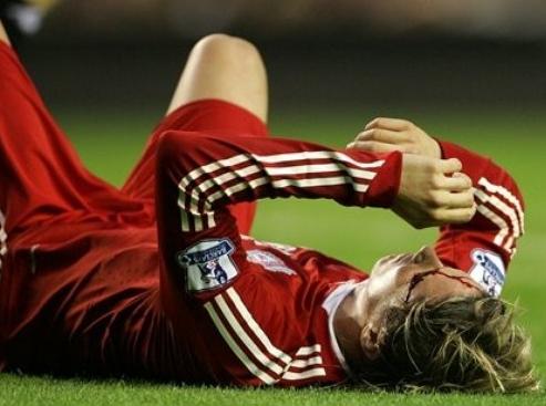 fernandotorres injury.jpg